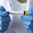 Japonya'da koronavirüs vakalarının sayısı bin 884'e yükseldi