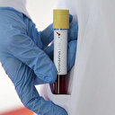 İngiltere'de koronavirüsten ölenlerin sayısı 759'a yükseldi