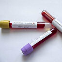 Özbekistan'da koronavirüs nedeniyle ilk ölüm