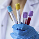 Dışişleri açıkladı: Koronavirüs nedeniyle 8 farklı ülkede 50 vatandaşımız hayatını kaybetti