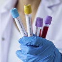 İBB çalışanı 350 kişide koronavirüs çıktı