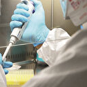 Hızlı tanı için kaydırma formülü: Günlük test sayısı 30 bini aştı