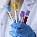 Pakistan'da Kovid-19'dan ölenlerin sayısı 100'ü aştı