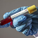 İstanbul'da 99 yaşındaki kadın koronavirüsü yendi