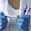 İngiltere'deki 80 Kıbrıslı Türk koronavirüs nedeniyle yaşamını yitirdi