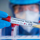Sokağa çıkma yasağı varken 38 bin test kime yapıldı?