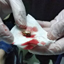 Evin önünde otururken vuruldu