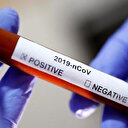 Afganistan'da koronavirüs vaka sayısı 18 bin 967'ye yükseldi