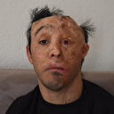 Mehmet Ali'nin ameliyatlarına koronavirüs engeli: Çok heves etmişti