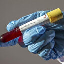 Dünya genelinde ağır koronavirüs bilançosu: Can kaybı 846 bin 792’ye yükseldi