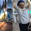 Rusya'da uyuyan kadının ağzından giren yılan ameliyatla çıkarıldı