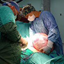 Niğde'de doktorları şaşırtan tümör hastanın karnından çıktı: 40 santimetre çapında 5 buçuk kilo ağırlığında