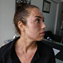 İzmirli genç kadının yaptırdığı 'gençlik aşısı' kâbusu oldu