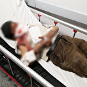 Köpeğin saldırısına uğradı: Yaşlı adamın yüzü parçalandı