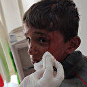 10 yaşındaki çocuğa öldüresiye dayak: Oğlunu hastanede tesadüfen gördü