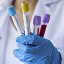 Tüketiciler Birliği: Özel hastaneler korona testi için ücret alamaz