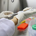 ABD’de 30 dakikada sonuç veren evde koronavirüs testi kiti FDA tarafından onaylandı