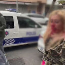 Gaziosmanpaşa'da kadına kafa atarak kanlar içinde bıraktı