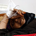 Yemen'de yılın ilk 10 ayında 204 bin şüpheli kolera vakası görüldü