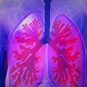 Dünyada yaklaşık 2 milyon kişi yaşamını yitirdi: Saatte 20 can alıyor