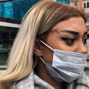 'Dünyaca ünlü doktor' yalanına kandı yüzündeki hasar iki haftadır geçmiyor