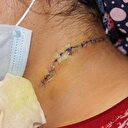 Eşi tarafından boğazı kesildi anne babası kurtardı