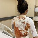 Kahvaltı için kendisini uyandıran eşi ve kızını kaynar suyla yaktı