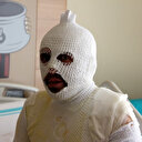 Akrabaları sobanın üstündeki kaynar güğümü başından aşağı döktü