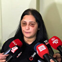 Samsun'da eski eşi tarafından darp edilen kadın konuştu: Tutuklu yargılanmasını ve ceza almasını istiyorum