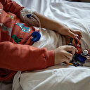 Çocukları tehdit eden MIS-C ile ilgili araştırmaya göre vakaların yarısı yoğun bakıma ihtiyaç duyuyor