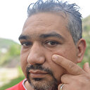 Göz altındaki metal parçayı 3 yıl sonra mıknatısla fark etti: Sadece orada bir sivilce gibi duruyordu