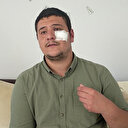 Lütfü Türkkan’ın kaçak çiftliğini görüntülerken darp edilen muhabir Akşener’i yalanladı