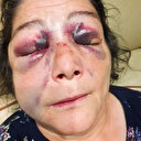 Başkan dövdürüp izledi