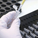 Yarım saatte 94 PCR testi