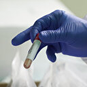 Sağlık ocağında ücretsiz PCR testi yapılıyor mu?