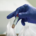 PCR test sonucu nasıl öğrenilir? Nabız girişi ile PCR test sonucu sorgulama ekranı