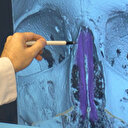 Prof. Dr. Aytuğ Altundağ: 'Tazı burunlular' daha yüksek risk altında