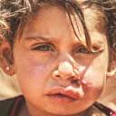 Tel Abyad’da
şark çıbanı tehlikesi