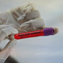 İşte Türkiye'de Omicron varyantının görüldüğü iller