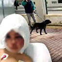 Pitbull saldırısına uğrayan minik Asiye yürekleri yaktı: Anne yüzüm iyileşecek mi?