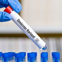 Omicron nasıl anlaşılır? Omicron belirtileri nelerdir?