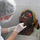 Nijerya'da Lassa ateşinden can kaybı artıyor: 32 kişi hayatını kaybetti