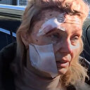 Rusya'nın bombalı saldırısında yaralanan öğretmen: Böyle bir şeyin ülkemizde gerçekleşebileceğini hiç düşünmezdim