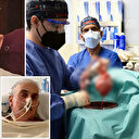 Tıp tarihine geçmişti: Domuzdan kalp nakli yapılan hasta öldü