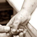 Avrupa'da bir ülkede daha maymun çiçeği virüsü tespit edildi: Ten rengi değişti