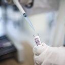 Maymun çiçeği Finlandiya'ya sıçradı: Avrupa seyahati sırasında enfekte oldu