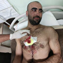 İnsanlık dışı muamele: Yunanistan sınırı geçmeye çalışan düzensiz göçmenlere karşı plastik mermi kullandı