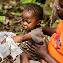 DSÖ açıkladı: Maymun çiçeği virüsü neden aniden dünyada endişeye neden oldu?