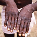 Dünya diken üstünde: Bir ülkeye daha sıçradı