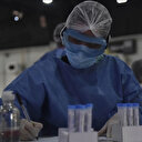 Maymun çiçeği virüsü kapıya dayandı: Komşu ilk vakayı açıkladı